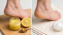 Kitchen Ingredients Heal Dry Cracked Heels Faster Than Most Store Bought Treatments